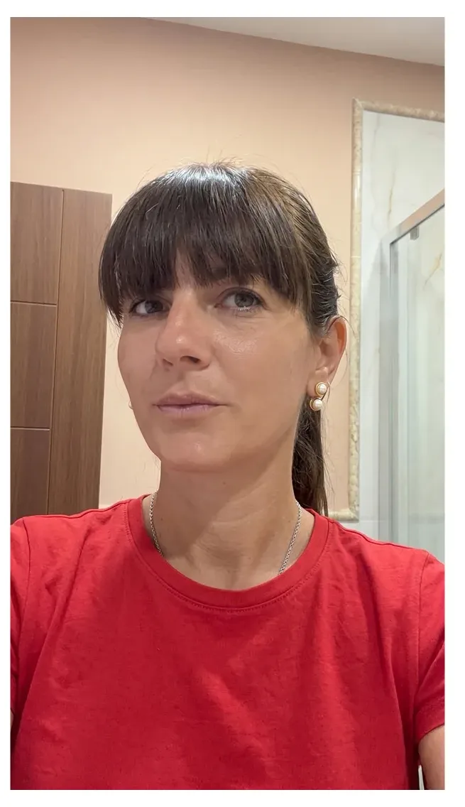 Жена след употреба на FlexRenew Forte